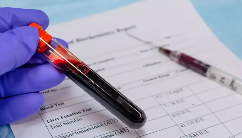 Ręka w niebieskiej rękawiczce trzyma probówkę z krwią, obok leży strzykawka i wyniki badań. To badanie krwi u psa.